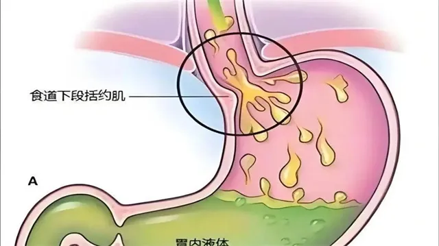 详细说明